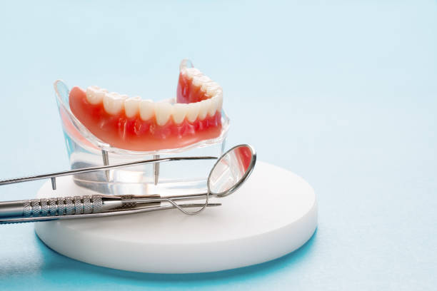 Dental Inlays and Onlays in Swannanoa, NC